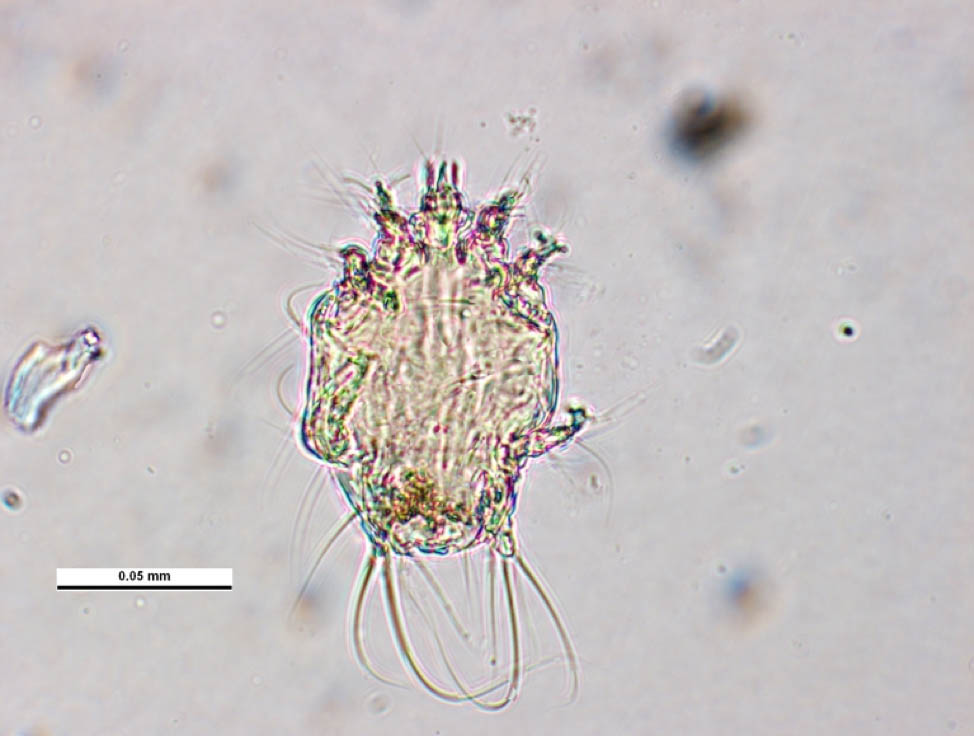 The image shows a microscopic view of a tracheal mite (Acarapis woodi), a parasite that infects honey bees. The mite is small, measuring about 0.05 mm, with a round, segmented body, short legs, and bristle-like structures extending from its body. Tracheal mites infest the airways of honey bees, potentially causing respiratory issues and impacting hive health.